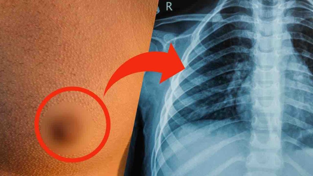 Capezzoli maschili, a cosa servono? La risposta la sanno in pochi