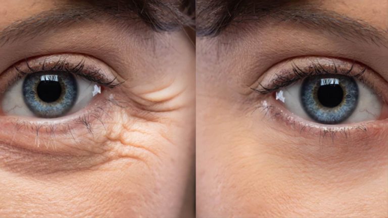 NOVEHA Salviette Oculari Asciutte Ipoallergeniche (60 Pz): Morbide E Resistenti Per Igiene Occhi Sensibili, Perfette Con Spray Acido Ipocloroso (Non Incluso)