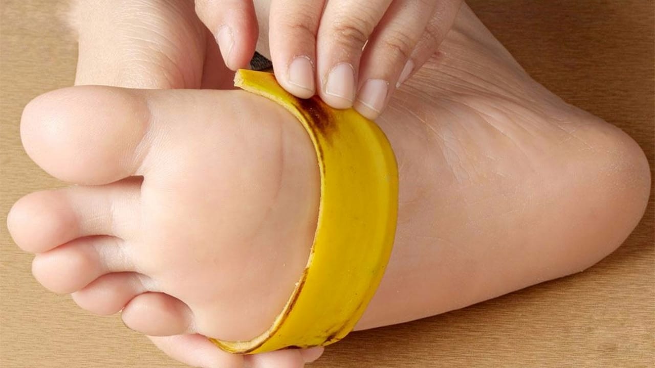 Buccia di banana sul piede