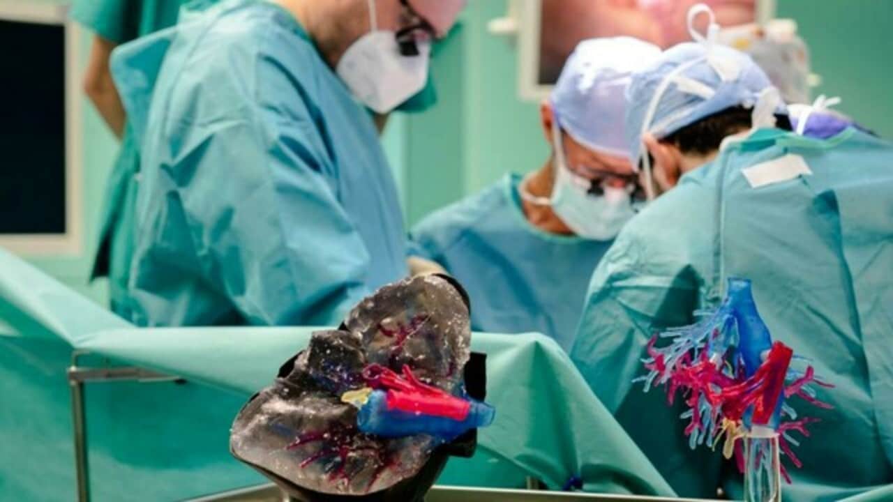 L'intervento all'aorta al Fatebenefratelli
