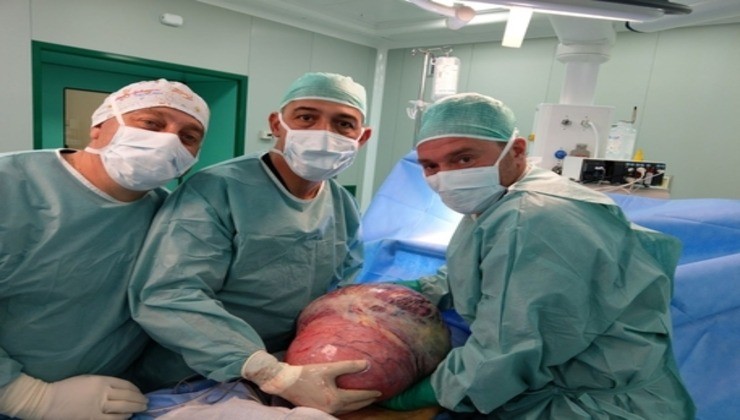 chirurghi asportano tumore