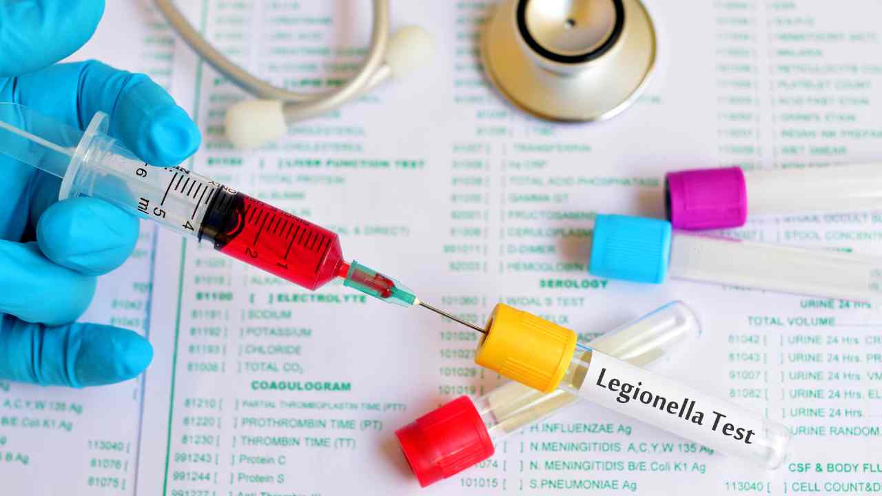 Legionella